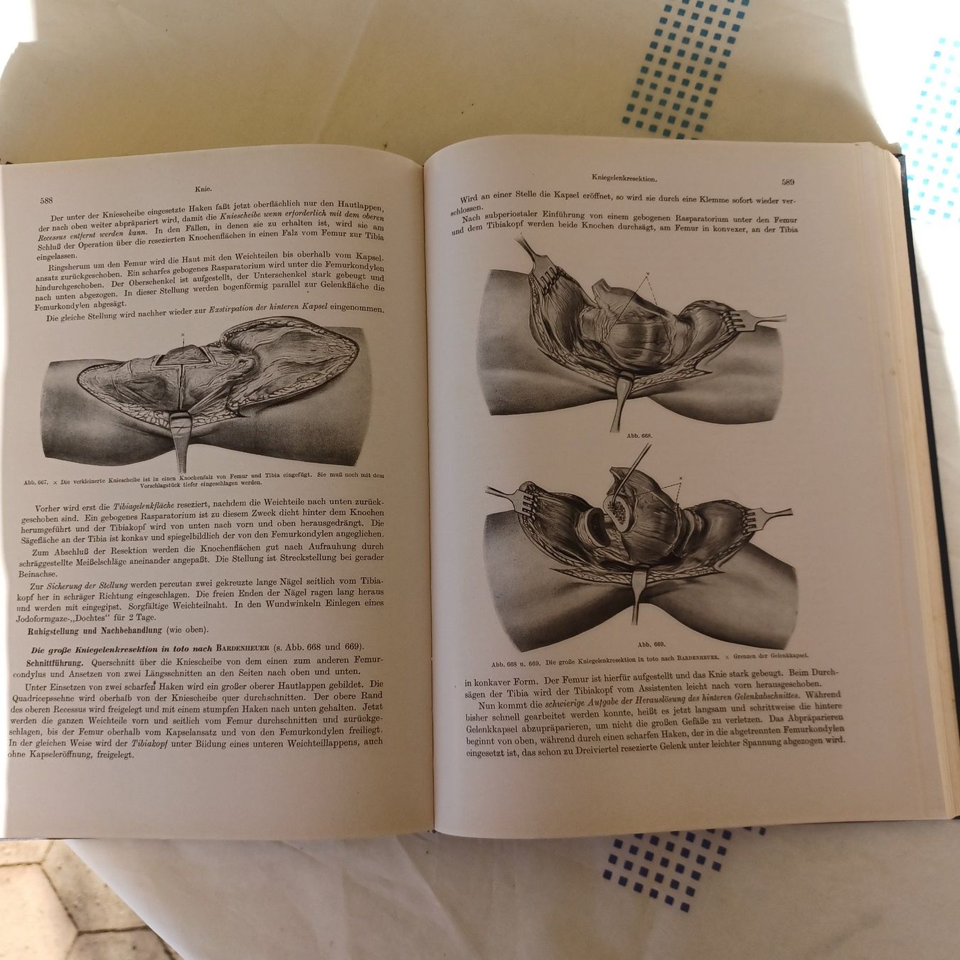 Bücher: Operationslehre von Max Lange 1951 – Gebraucht aus Abtwil SG von luupsy 9