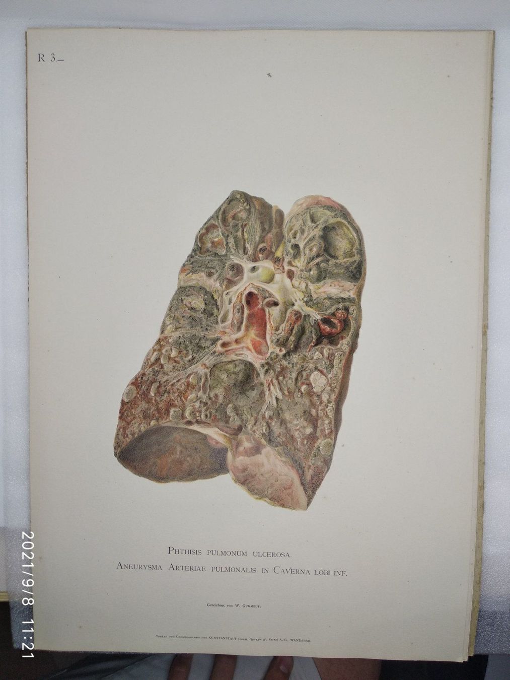Libri: MEDIZIN - ANATOMIE - KAST - RUMPEL - P – Usato da Goldach venduto da Gaip 1