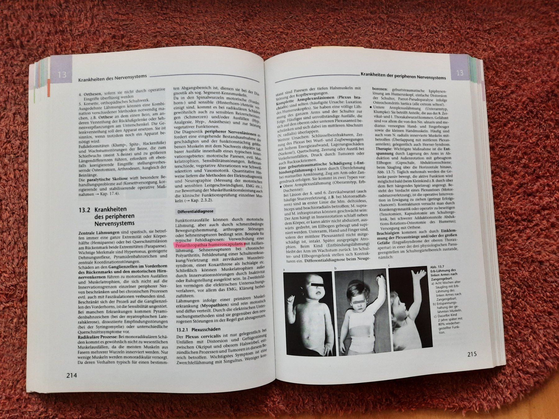 Libri: Orthopädie Rössler/Rüther - 18. Auflage – Usato da Niederrohrdorf venduto da Sweetcat 2