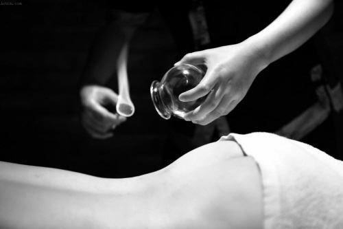 Massagegeräte: Schroepfglaeser Schröpfen Schroepfglas – Neu (gemäss Beschreibung) aus Thun von nuonuo 5
