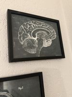 Anatomie Poster Set 3 Bilder gerahmt schwarz guter Zustand