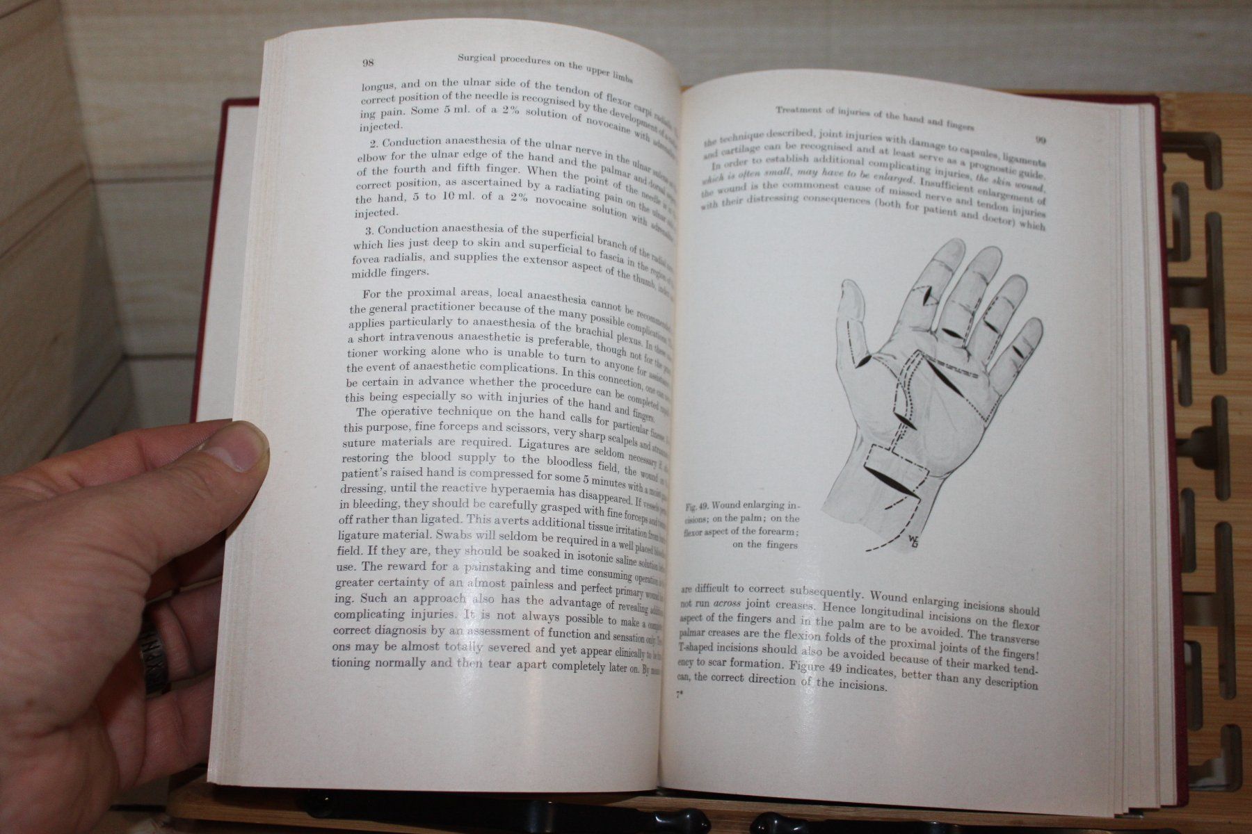 Libri: Operations in the practitioner`s surgery-G.Jorns 1963 – Usato da Kaden venduto da Buchantiquariat 5