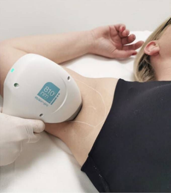 Epilatori: Elysion Pro Diodenlaser | Haarentfernung | Profi Gerät – Usato da Dättwil AG venduto da tug_yf5v 3