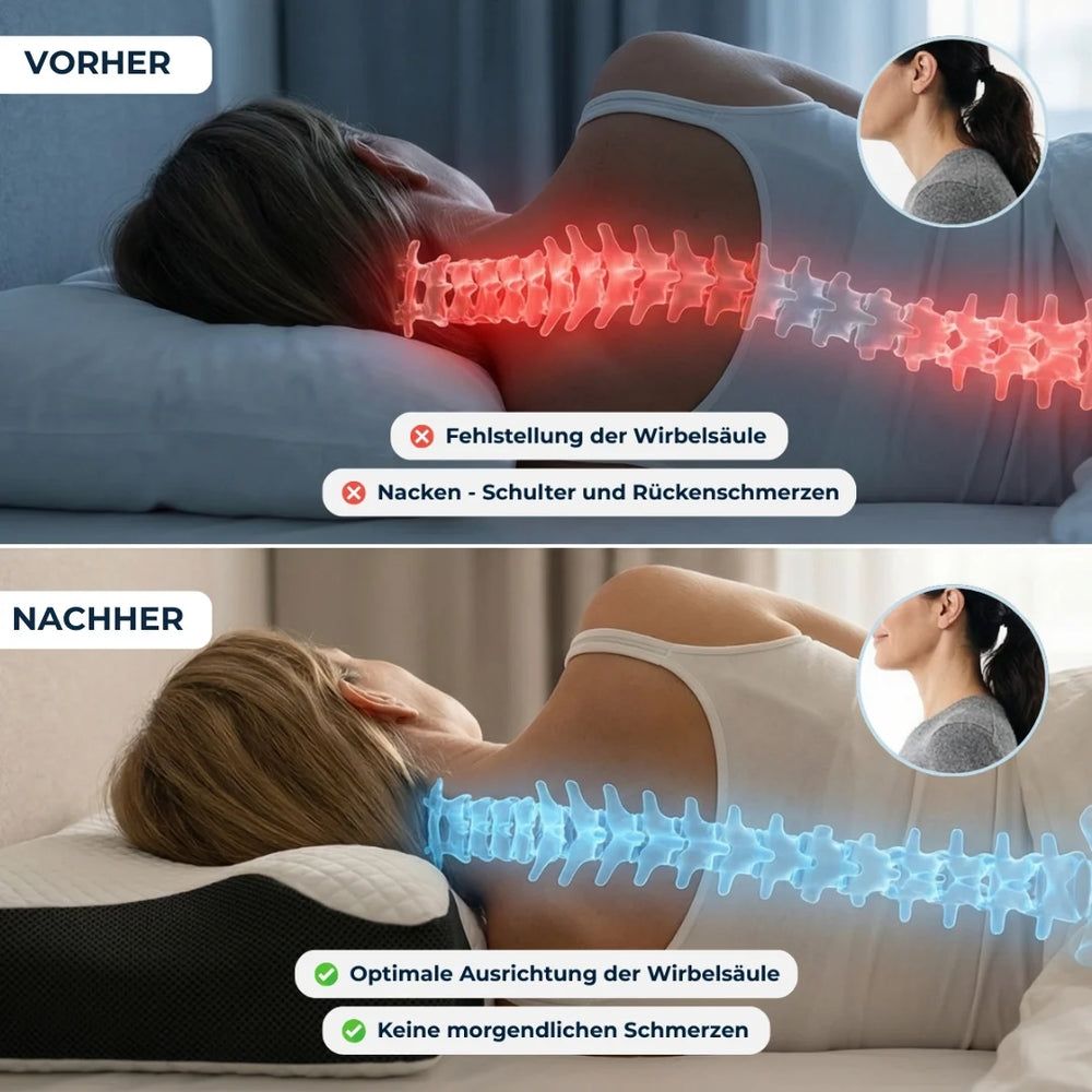 Cuscini: CuroSleep Kissen – Nuovo e nell'imballaggio originale da Gwatt (Thun) venduto da Alonso82 3