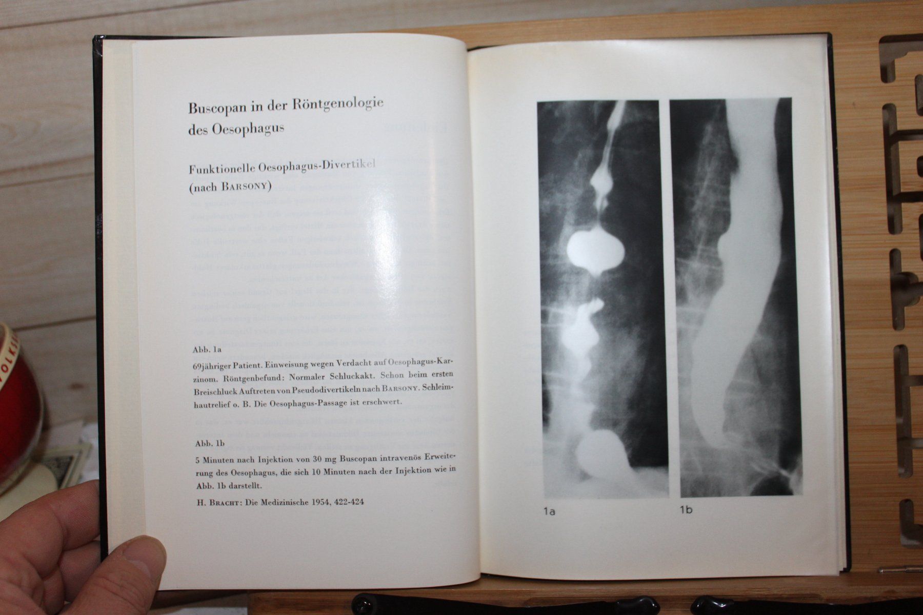 Libri: Spasmolyse im Röntgenbild – Usato da Kaden venduto da Buchantiquariat 1