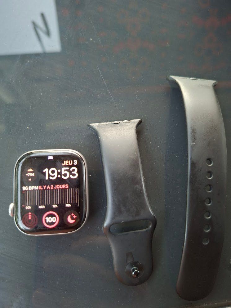 Apple Smartwatch: Apple watch serie 11 GPS+ cellular Grey – Usato da Vallorbe venduto da val_r78w 3