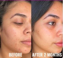 Cura del viso: Good Molecules Niacinamide Texture & Pore Refining Set – Nuovo e nell'imballaggio originale da Cham venduto da Trendy_Outlet 4