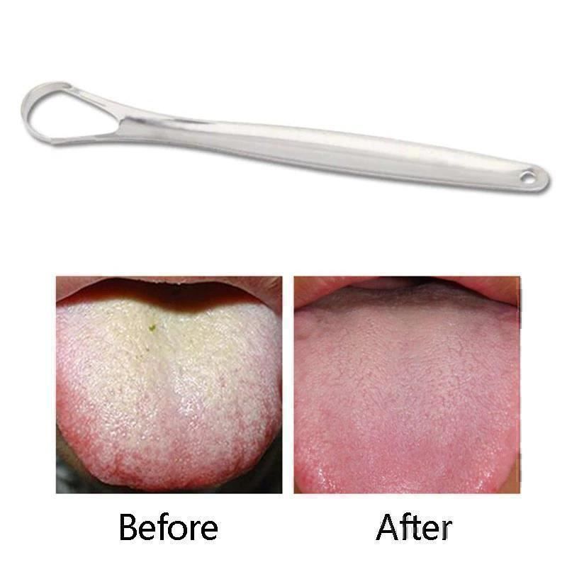 Zahnpflege: Grattoir à langue acier inoxydable – Neu und originalverpackt aus Gurmels von Swisspod 1