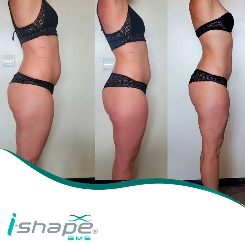 Appareils de massage: i-model esthetic  – Neuf (Voir description) à Frauenfeld par ren_8xzb 6