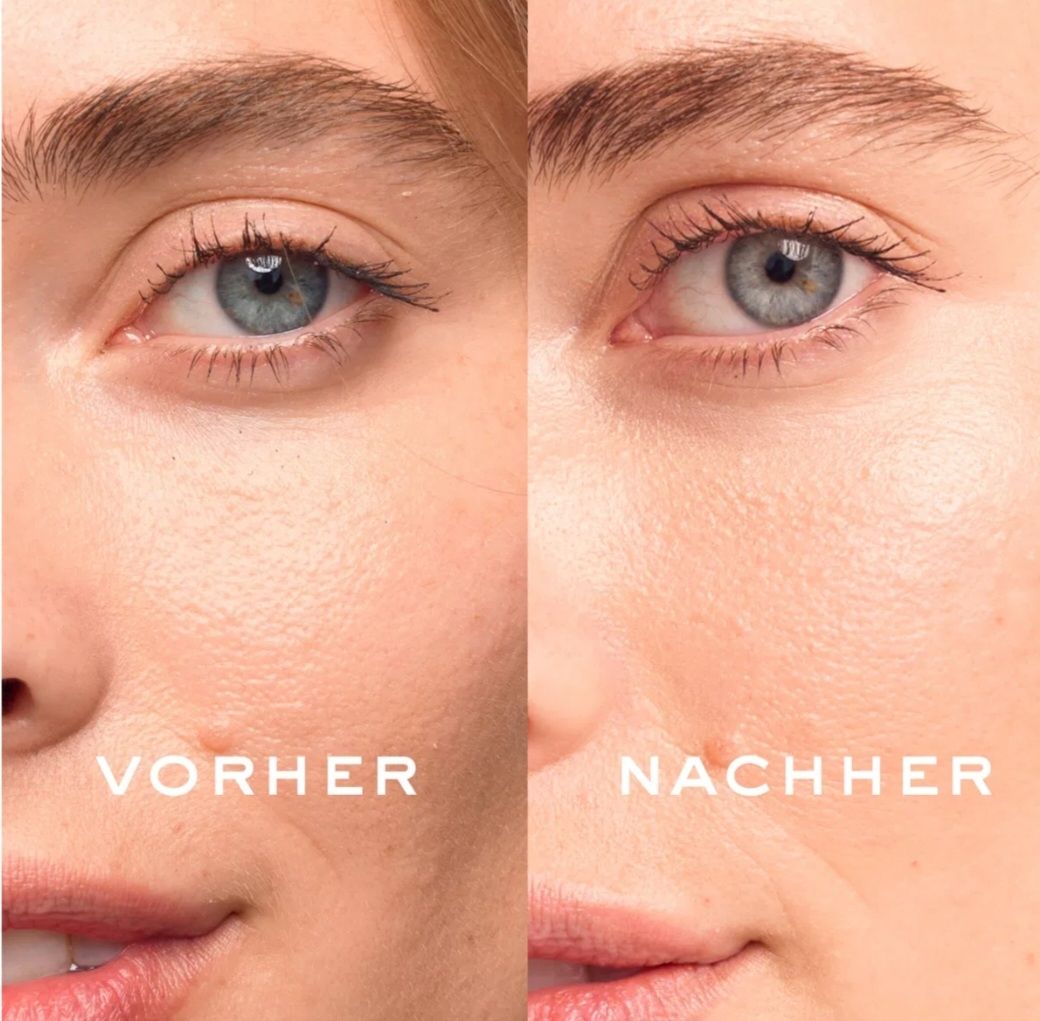 Nuxe Cura del viso: Nuxe Eye Lighter Serum – Nuovo e nell'imballaggio originale da Eschenbach SG venduto da smu_2mkd 5