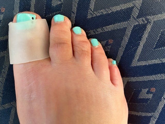 Pedicure: Zehenschutzring G gross... – Nuovo (secondo la descrizione) da Nottwil venduto da Frontal