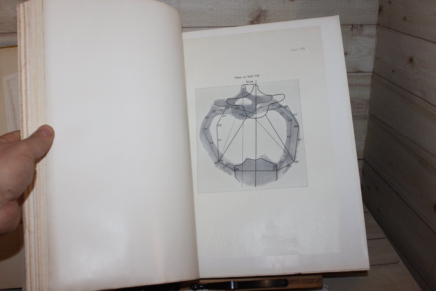 Libri: Der Thorax Phthisicus - eine anatomisch-physiologische Studi – Usato da Kaden venduto da Buchantiquariat 2