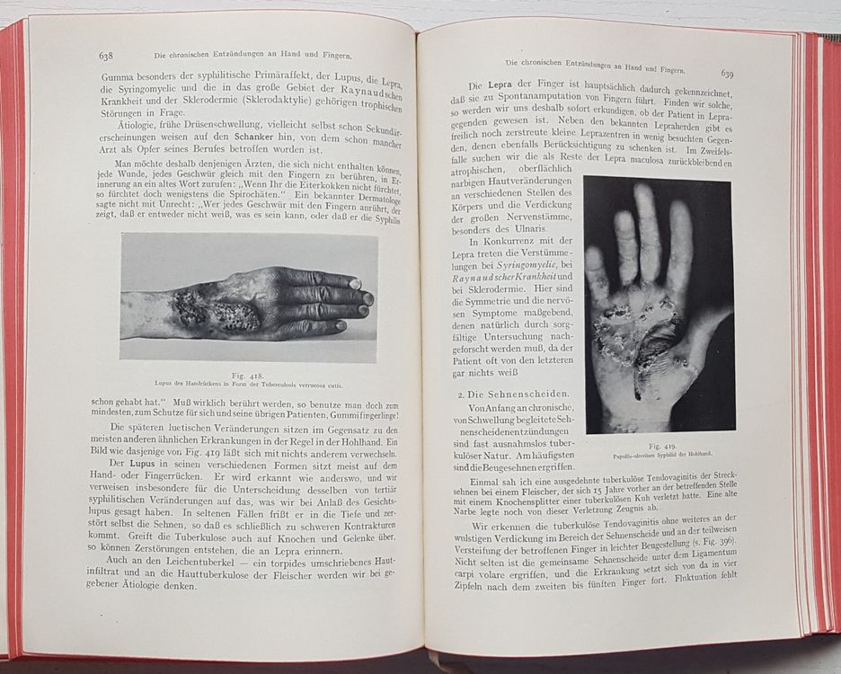 Fritz de Quervain Spezielle chirurgische Diagnostik (1915) Kaufen