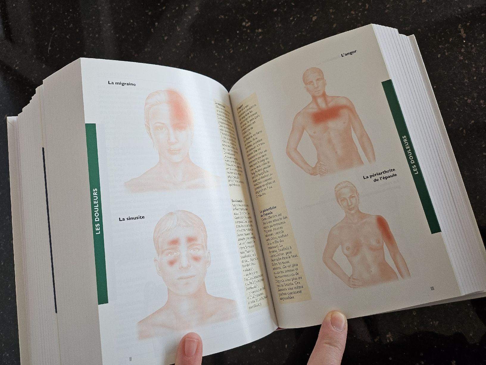 Libri: Larousse de la médecine - 5000 articles – Usato da La Joux FR venduto da car_ck96 3