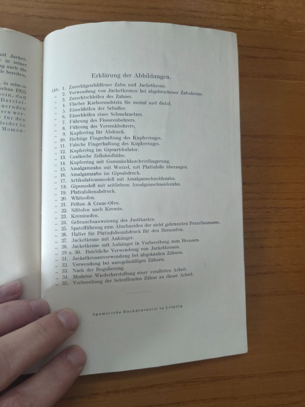 Bücher: Lewin – Die Jacketkrone 1925 – Zahnmedizin – Gebraucht aus Aldesago von lusuardi 7
