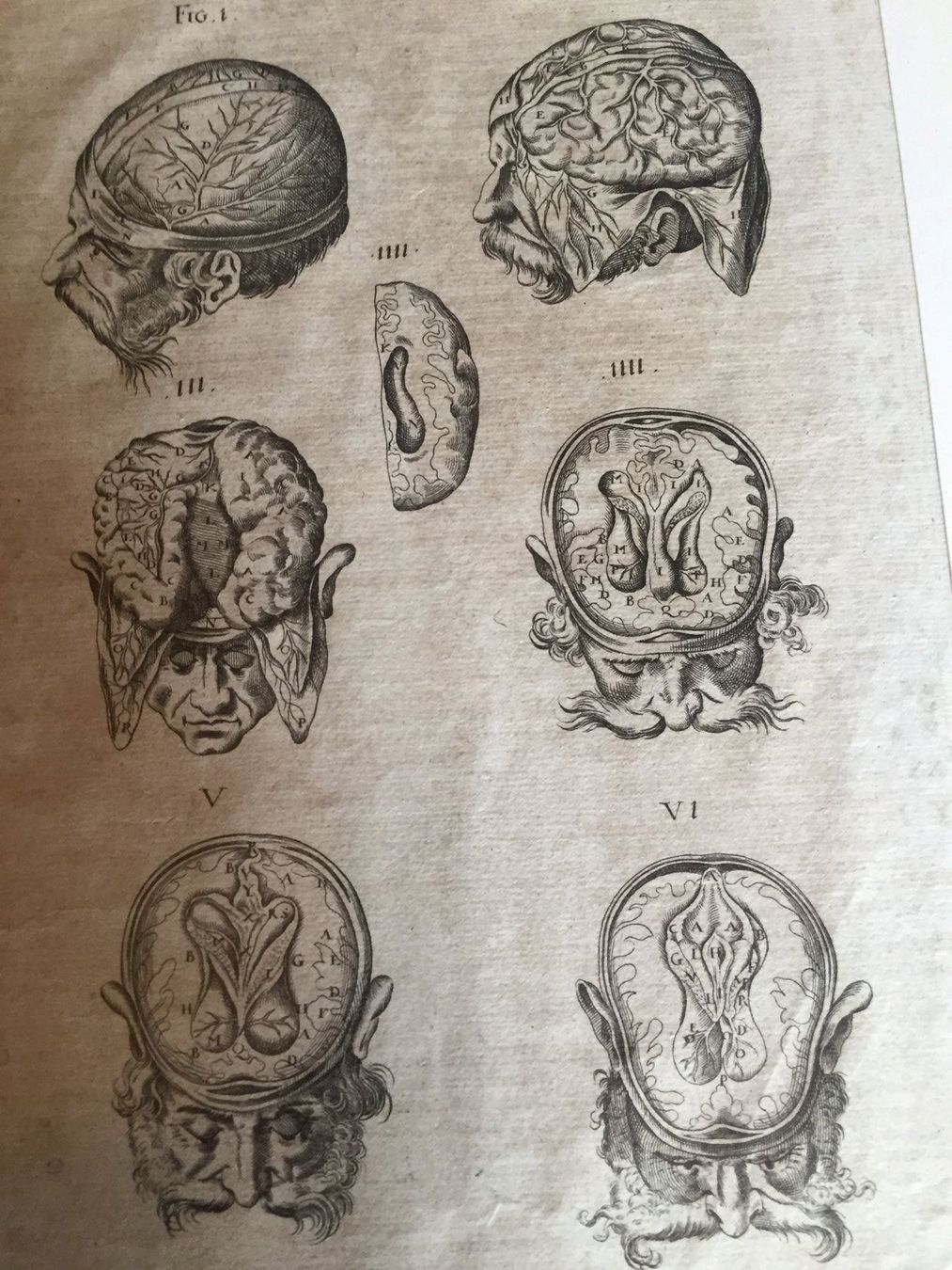 Stiche: Anatomie Selten ORIGINAL – Gebraucht aus Trachslau von post35 1