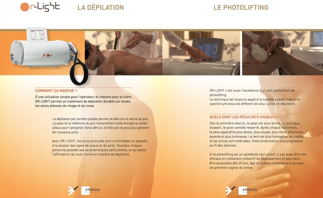 Epilatori: YPERION Or-Light Système IPL – Usato da Choëx venduto da Doudoune1 5