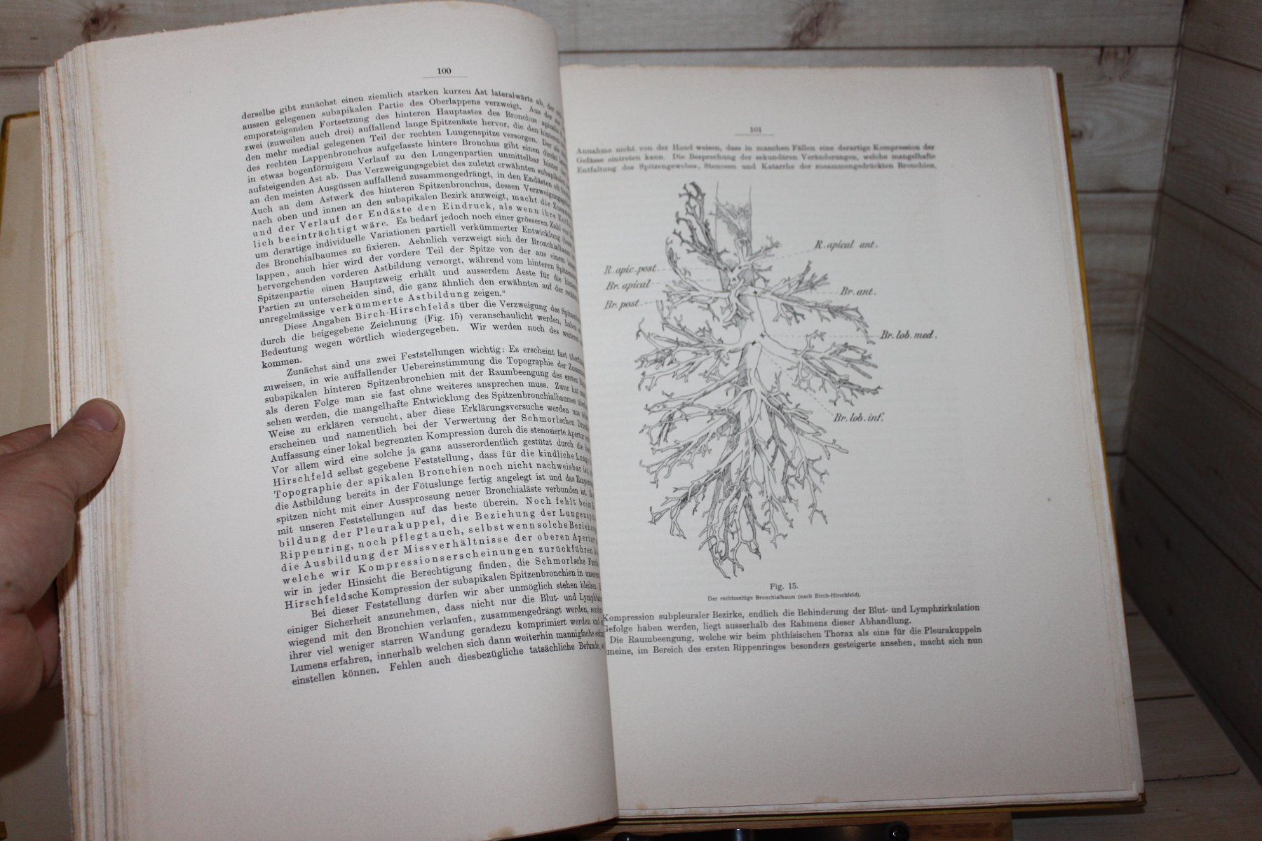 Libri: Der Thorax Phthisicus - eine anatomisch-physiologische Studi – Usato da Kaden venduto da Buchantiquariat 4