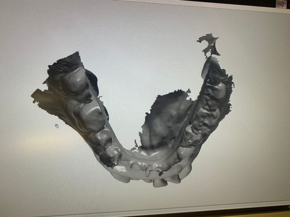 Straumann Dental Wings 7 Series 3D Scanner Kaufen auf Ricardo