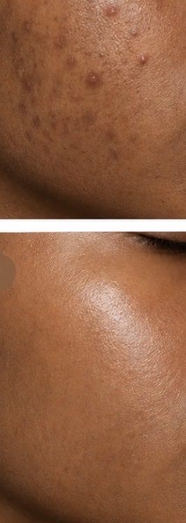 Gesichtspflege: Lotion visage et corps  – Neu und originalverpackt aus Genève von tch_dw9w 1