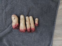 Blutige Finger Set Halloweendeko Plastik