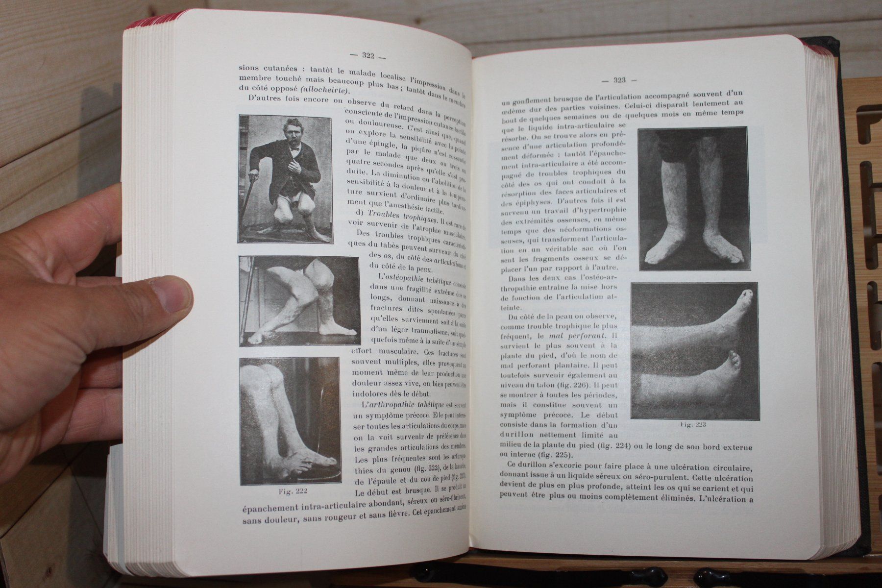 Libri: Les Maladies Nerveuses - A. van Gehuchten 1951 – Usato da Kaden venduto da Buchantiquariat 4
