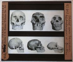Glasdia: Schädel v. Europäer, Australneger, Gorilla, um 1920
