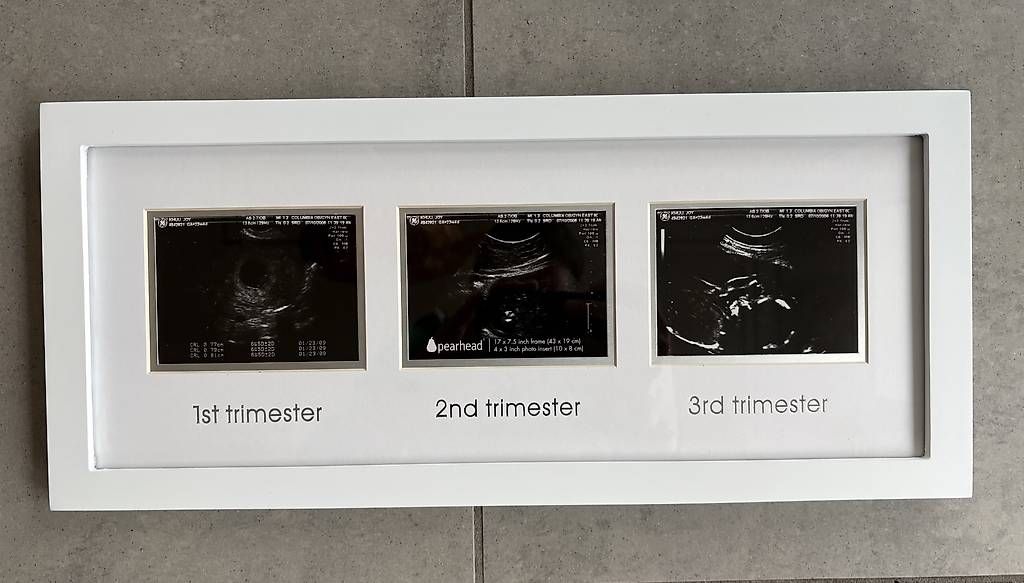 Cornici: Pearhead Rahmen Ultraschallbilder – Nuovo (secondo la descrizione) da Lachen SZ venduto da Lachen-8853