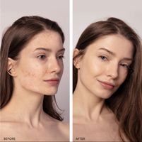 FOREO Espada 2 Plus Hautpflege Lila