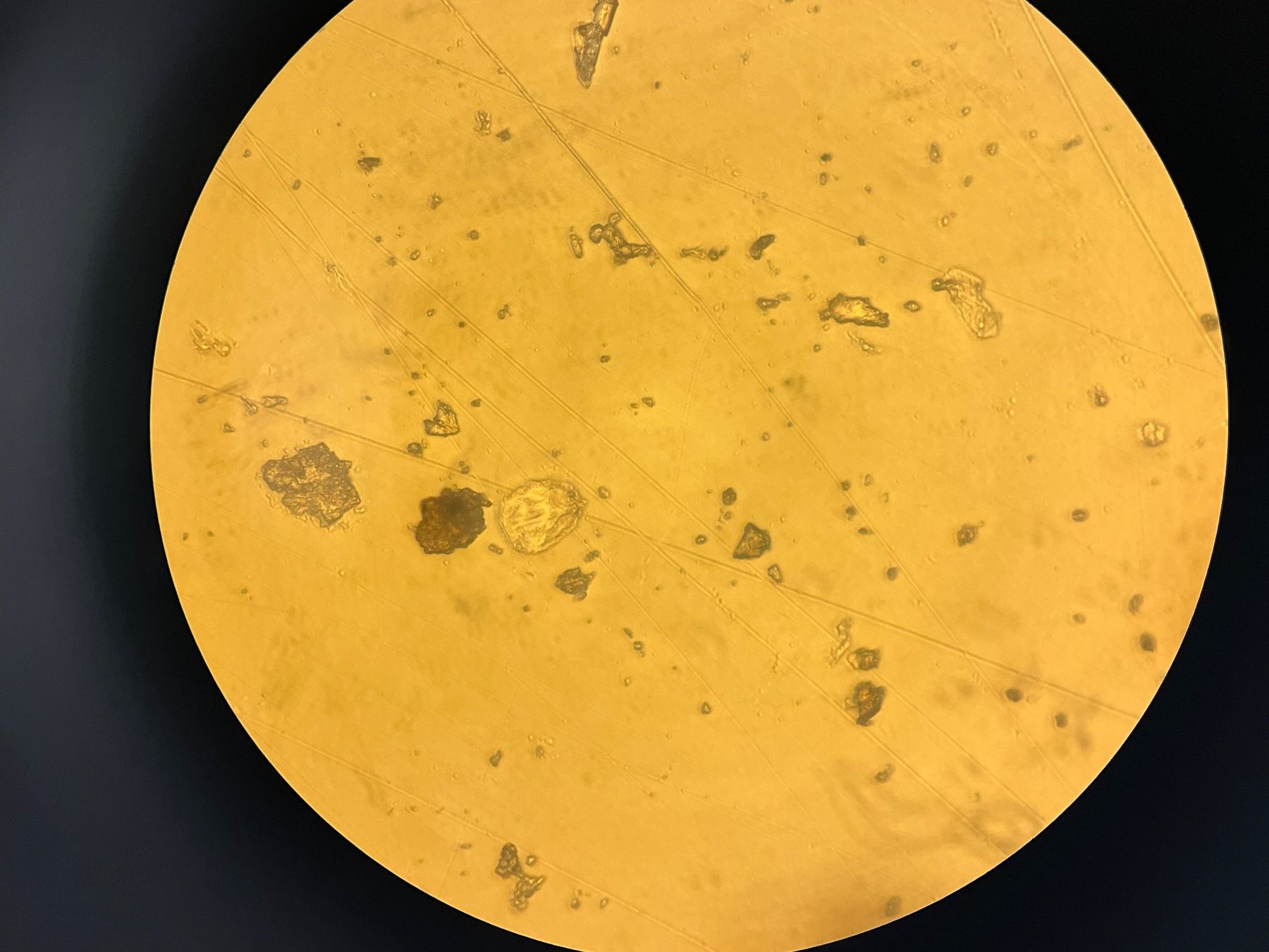 Zeiss Microscopi: Zeiss Axiovert 25 Inversmikroskop mit Phasenkontrast – Usato da Niederdorf venduto da LeptonAG_Labor 8
