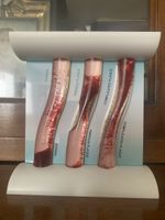 Anatomie Modell, Arterien mit Plaque, sehr anschaulich!