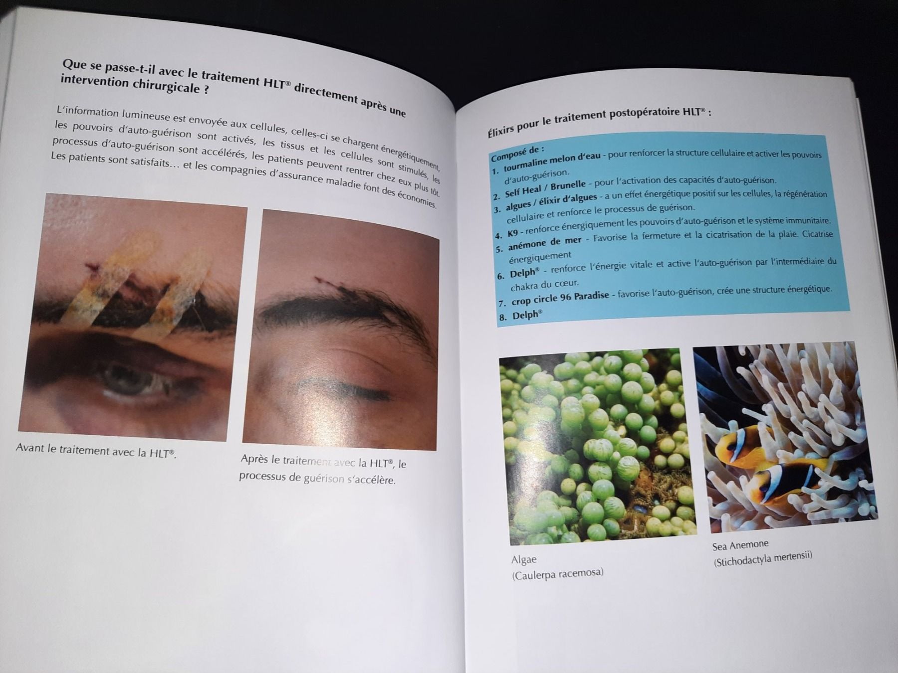 Bücher: Luminothérapie Holistique HLT – Gebraucht aus Biasca von Old_6blh 4