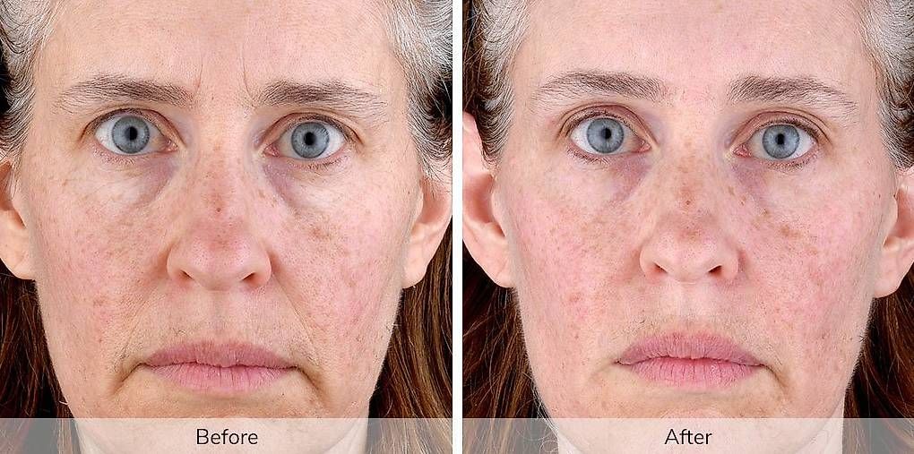 Gesichtspflege: Ivory by Elevare Skin  – Gebraucht aus Tentlingen von Sunshine1734 2