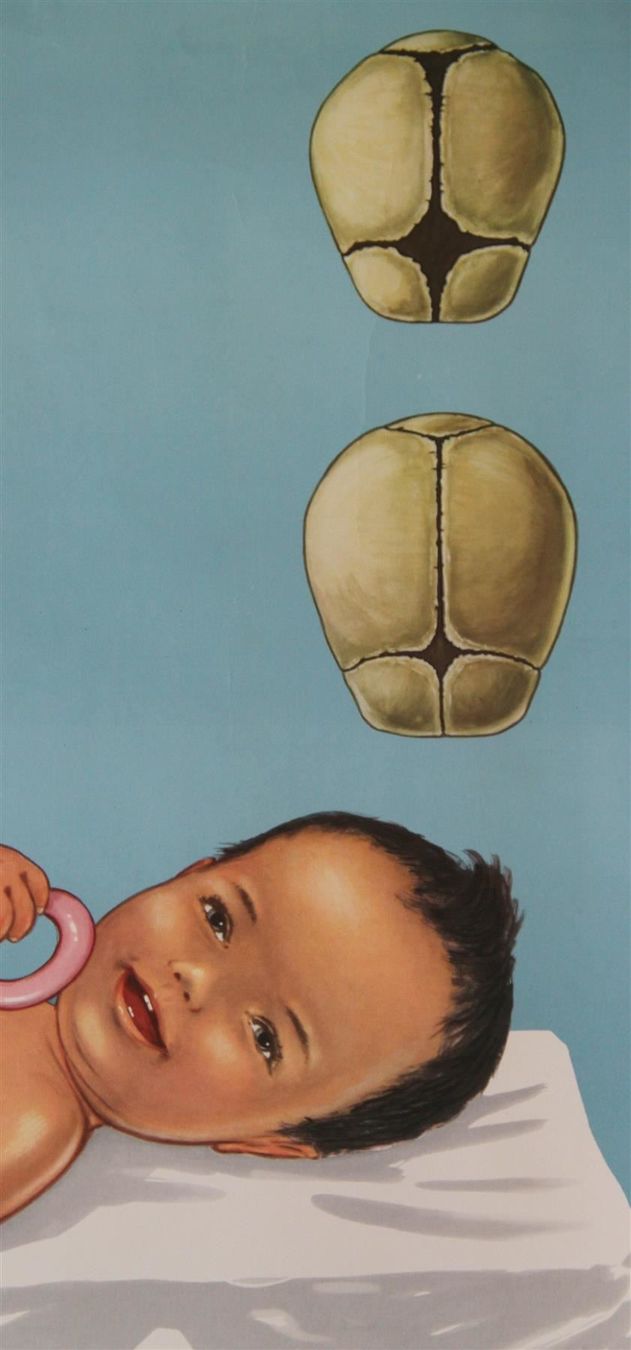Poster & Bilder: Schulwandbild "Baby & das Zahnen" – Gebraucht aus Birrwil von brandschatz_birrwil 5