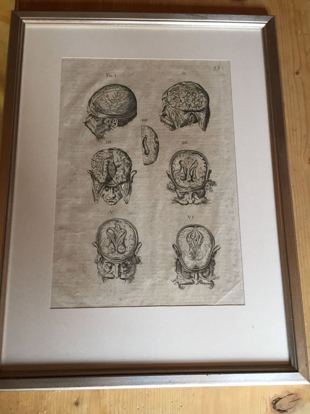 Stiche: Anatomie Selten ORIGINAL – Gebraucht aus Trachslau von post35