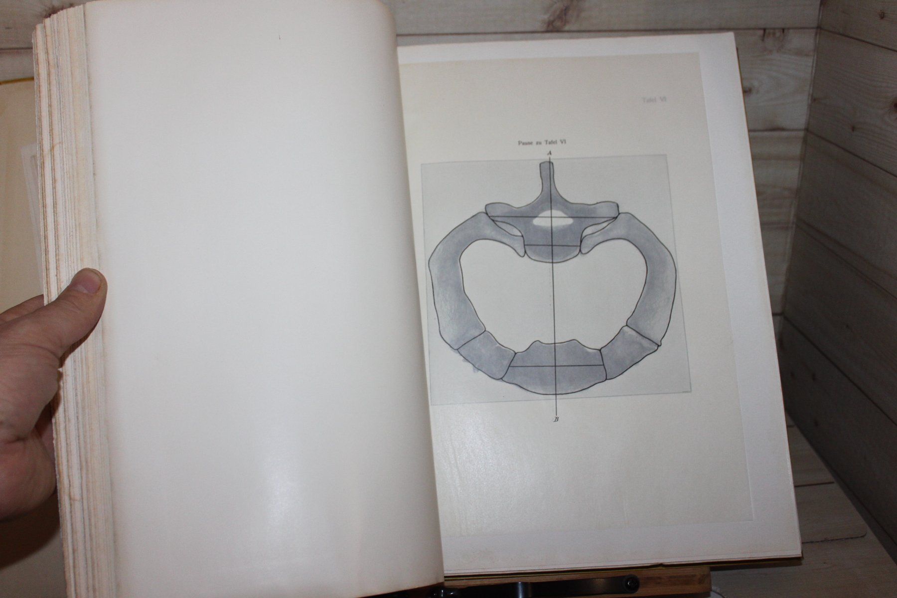 Libri: Der Thorax Phthisicus - eine anatomisch-physiologische Studi – Usato da Kaden venduto da Buchantiquariat 3