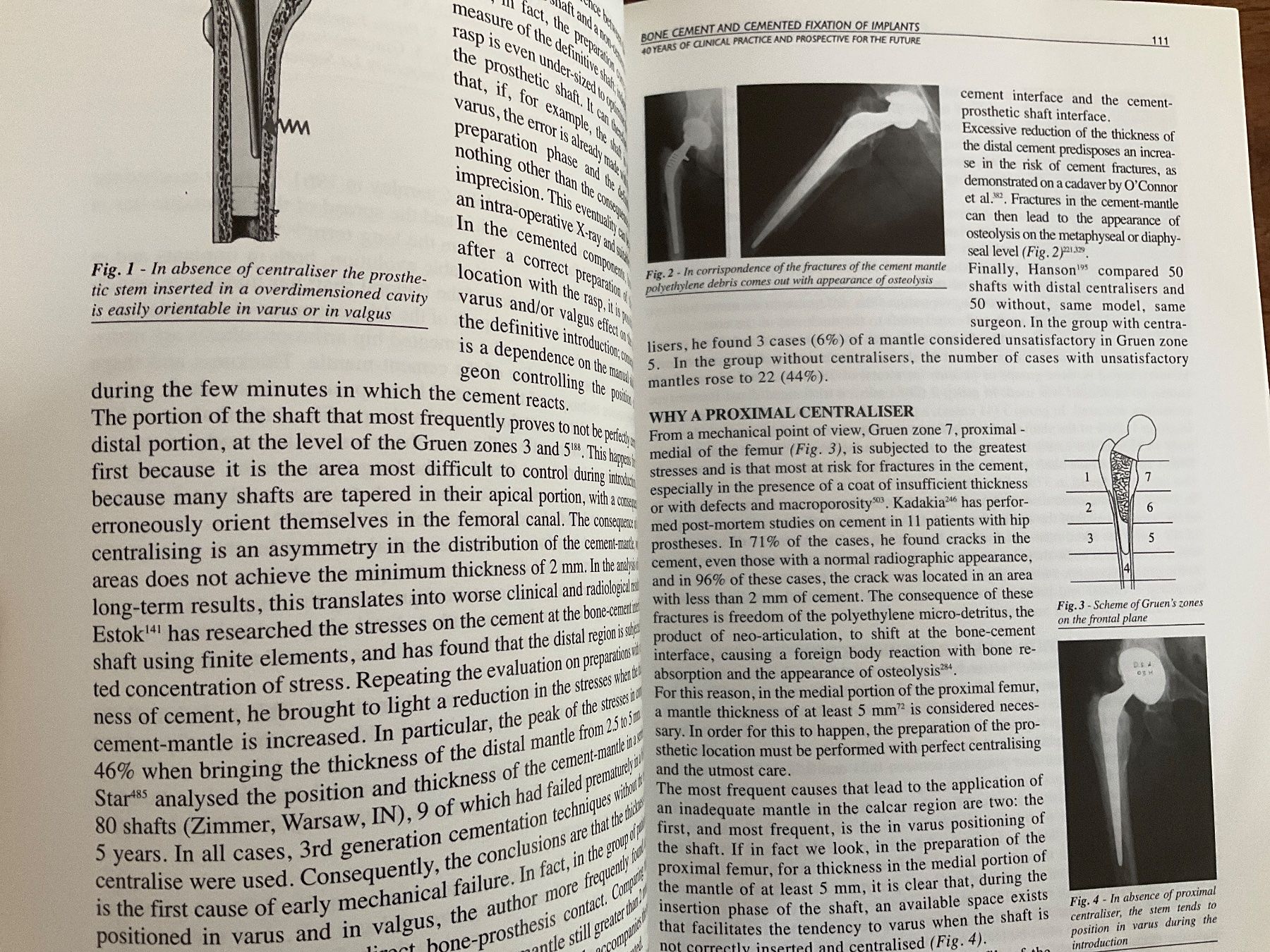 Livres: Bone Cement and Cemented Fixation of Implants📚2001 – D'occasion à Avenches par Lactobacille 3