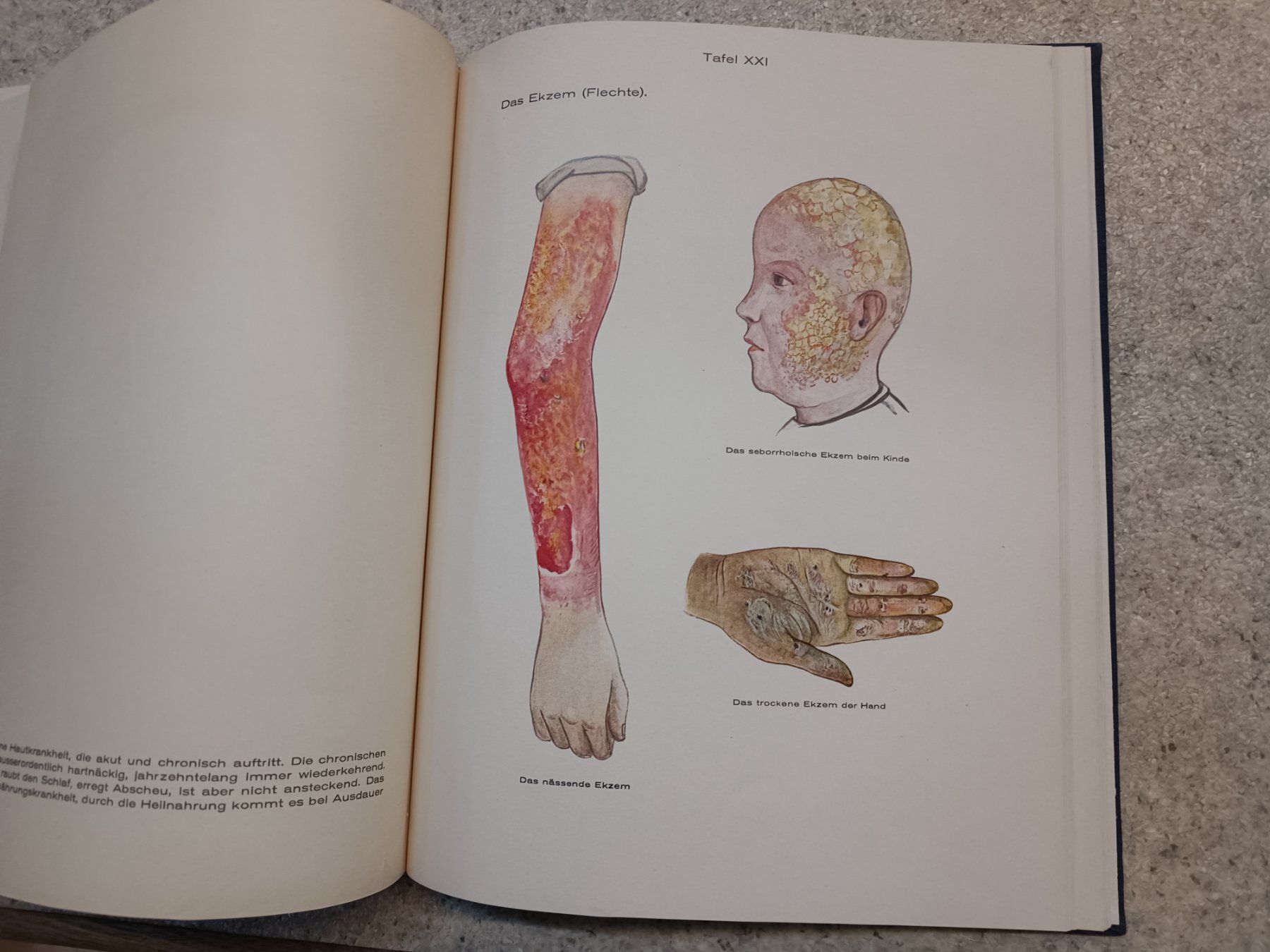 Libri: Wendepunktbücher Nr. 18 Nährschäden in Wort und Bild Bircher – Usato da Reiden venduto da Zofi-Brocki 2
