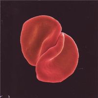 Peter Gabriel - Scratch My Back (Special Edition, 2 CDs)