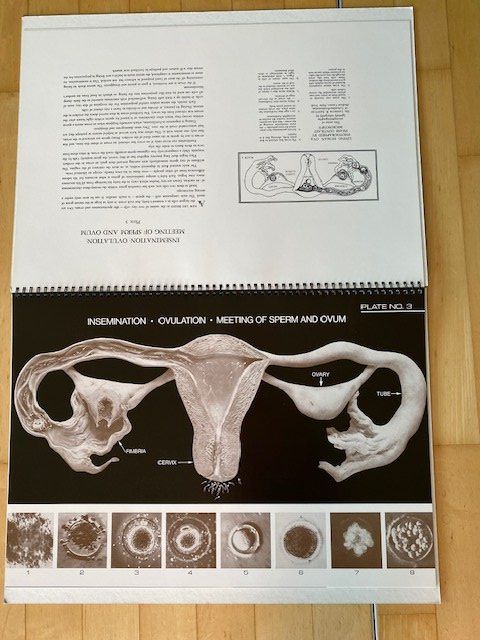 Bücher: Birth Atlas R. Dickinson – Gebraucht aus Edlibach von Arnoldotto 3