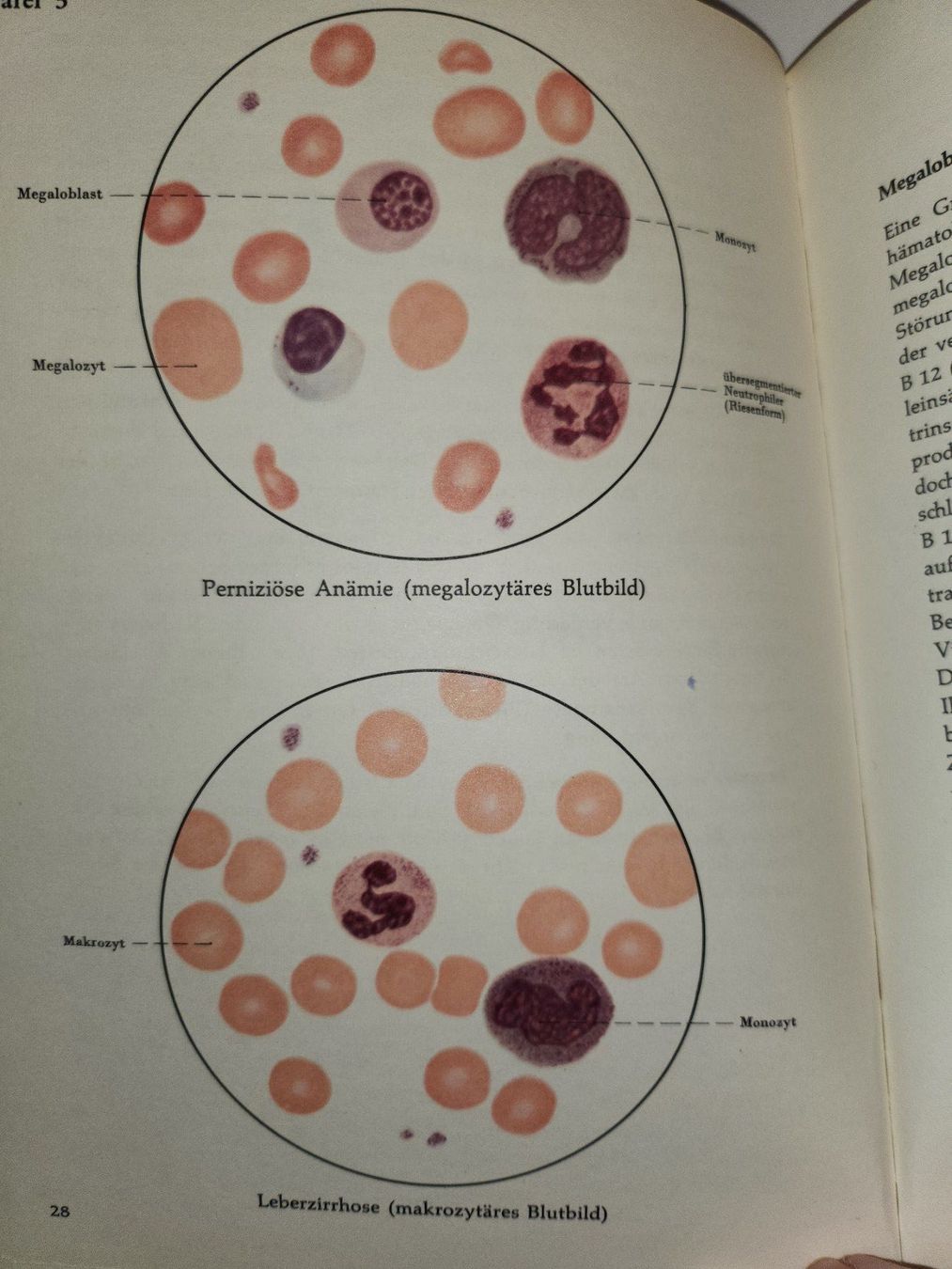 Libri: Tabulae haematologicae - Hämatologie Bildatlas – Usato da Dietikon venduto da Buchantiqdietikon 2