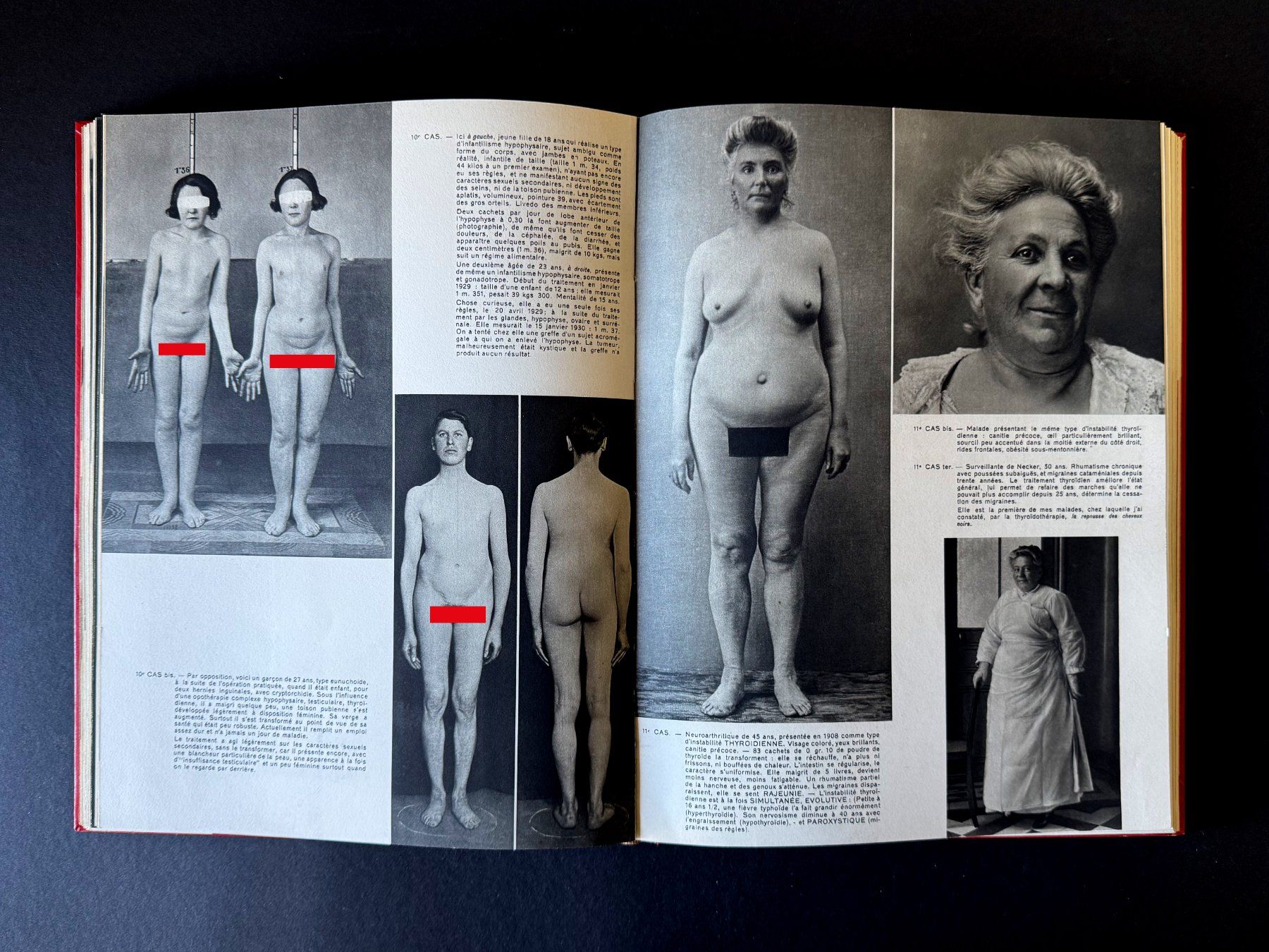 Libri: La collection des Documents Médicaux. Robert Lang. Paris. – Usato da Zürich venduto da Tulsa1968 5