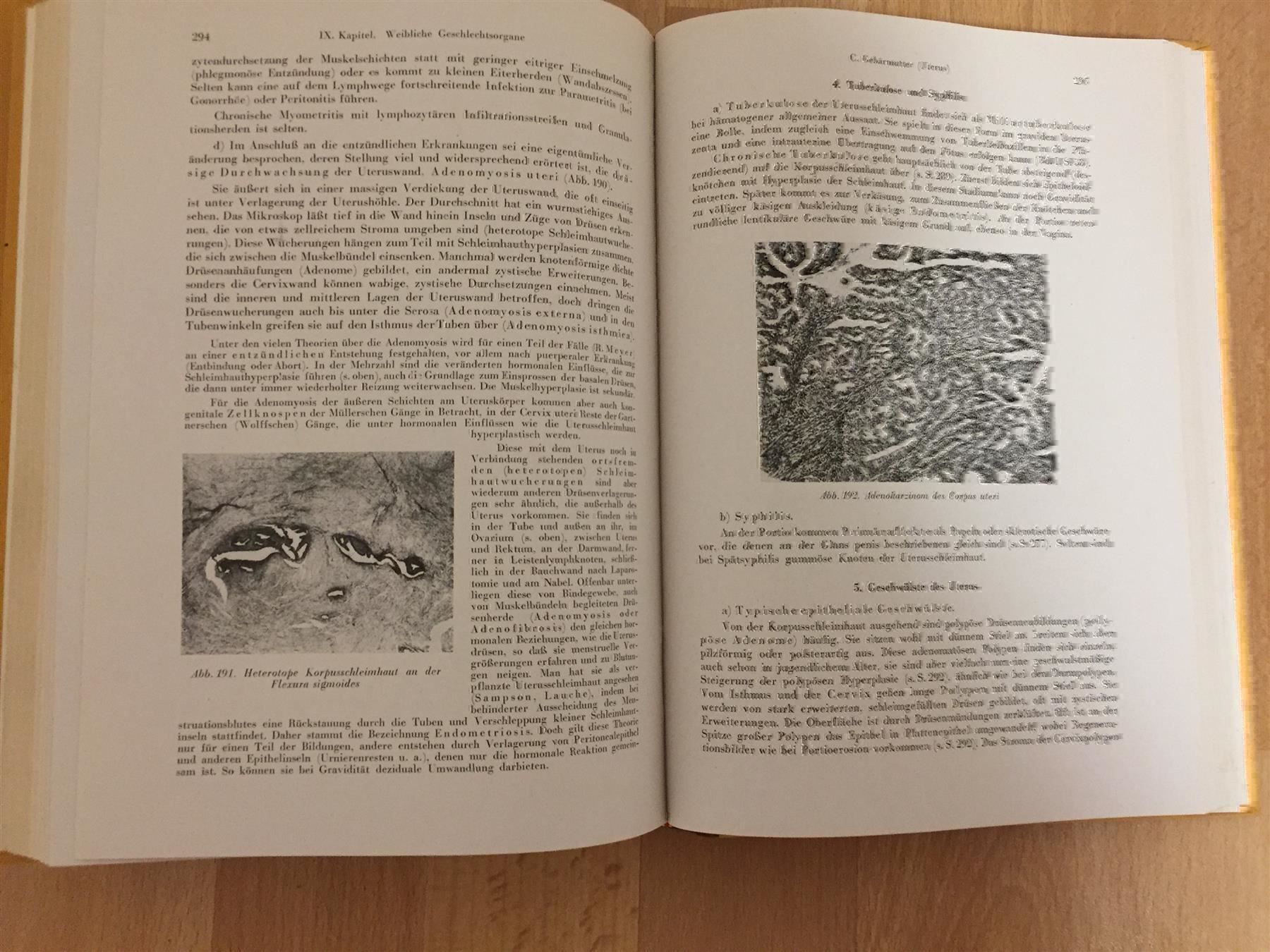 Bücher: A. Dietrich. «Allgemeine Pathologie und – Gebraucht aus Cormagens von Bonsai111 6