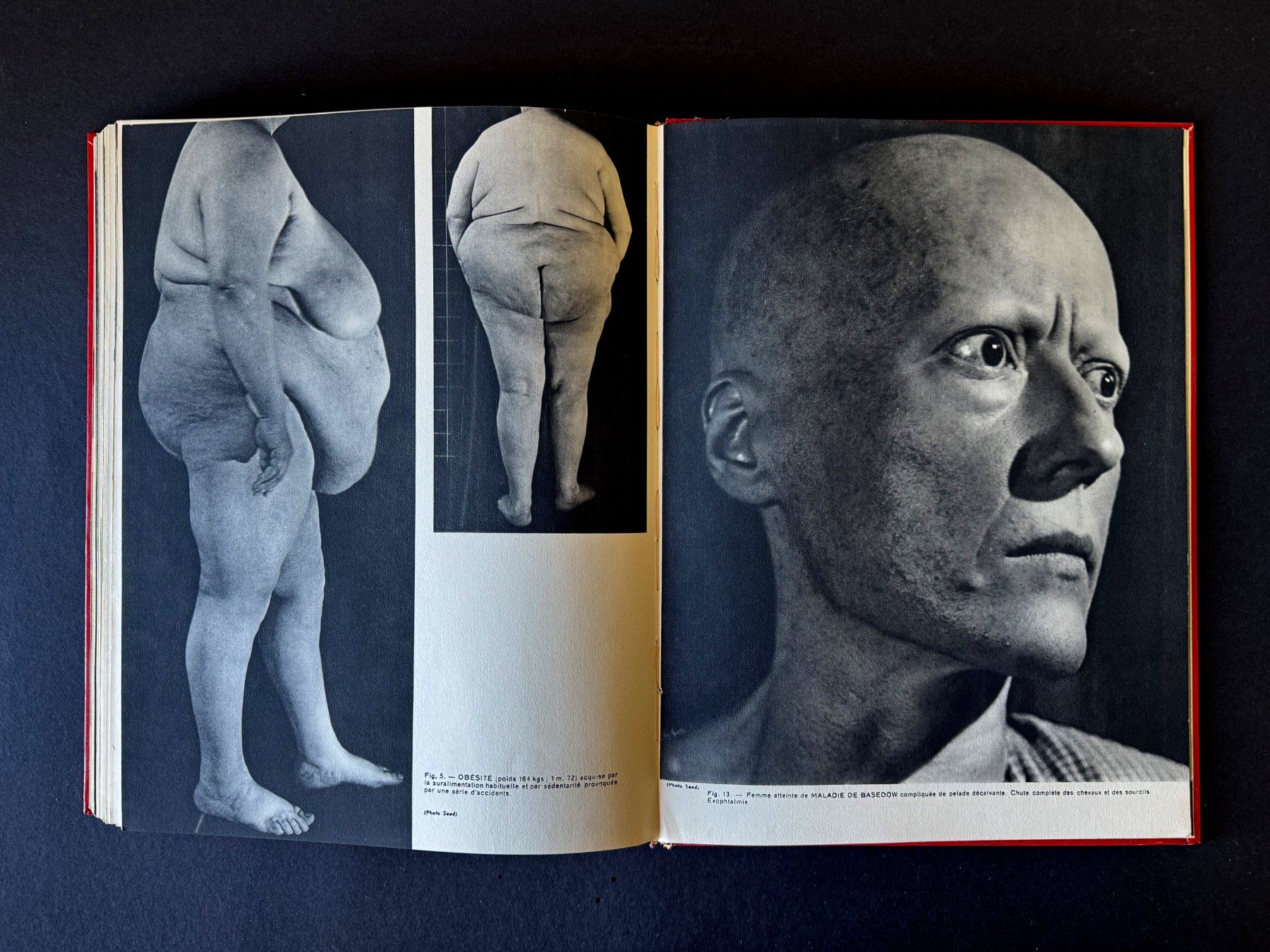 Libri: La collection des Documents Médicaux. Robert Lang. Paris. – Usato da Zürich venduto da Tulsa1968 7
