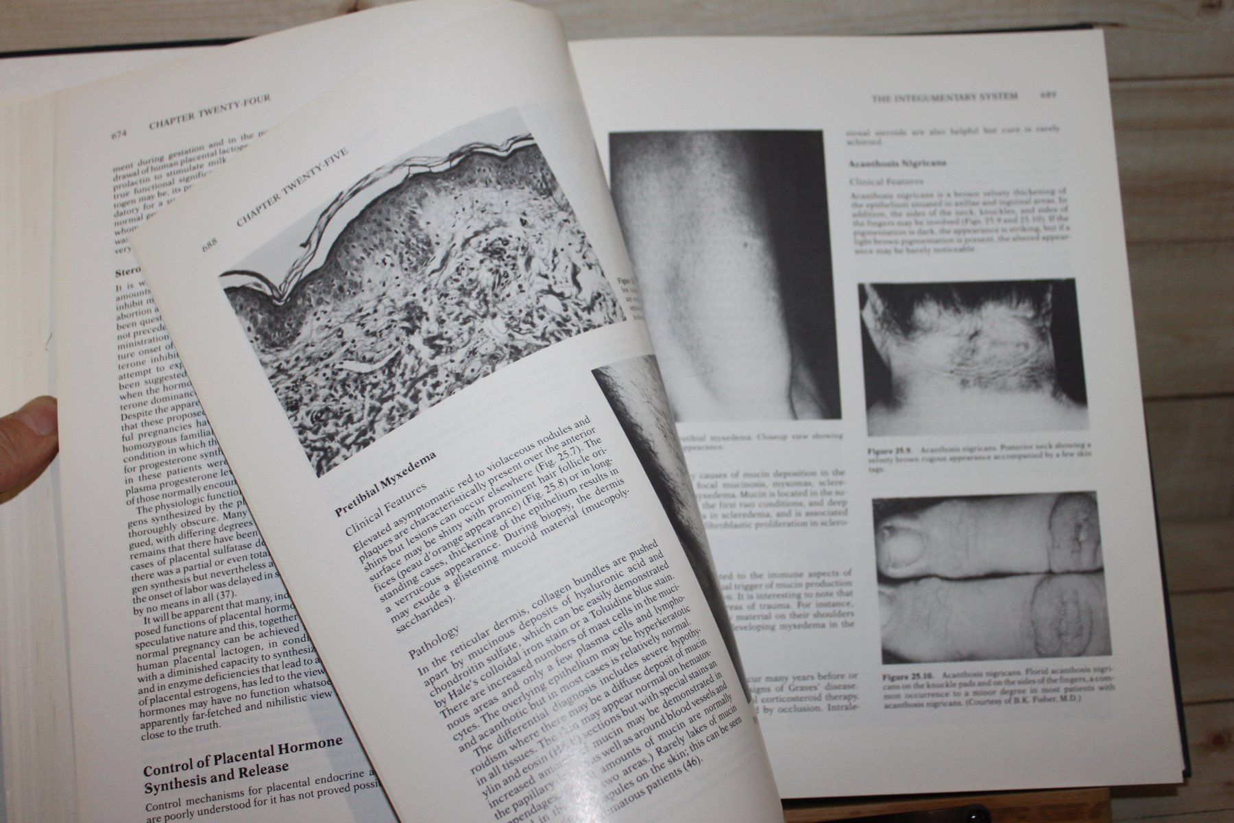 Libri: Functional Endocrine Pathology Vol. I+II – Usato da Kaden venduto da Buchantiquariat 5