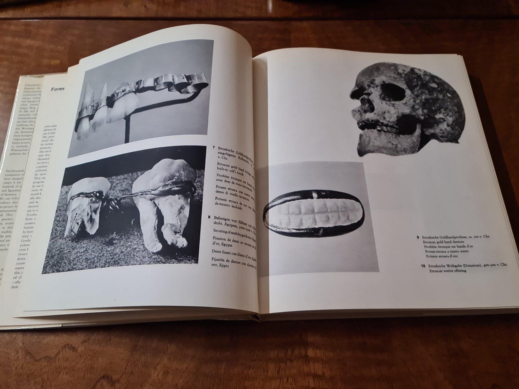 Libri: Bildgeschichte der Zahnheilkunde – Usato da Erstfeld venduto da Uhu1980 1