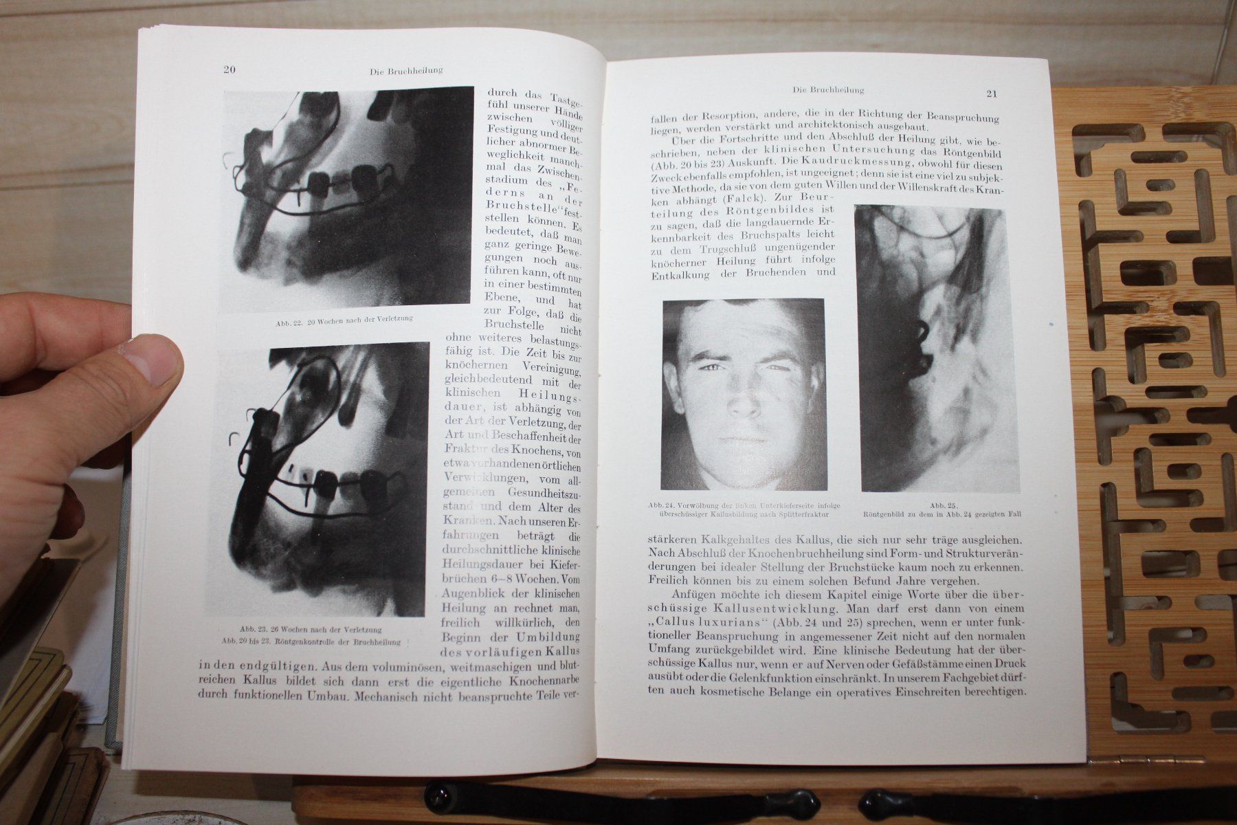 Libri: Leitfaden der Kieferbruchbehandlung-Erwin Reichenbach – Usato da Hilgert venduto da Kerrys-Zubehoershop 3