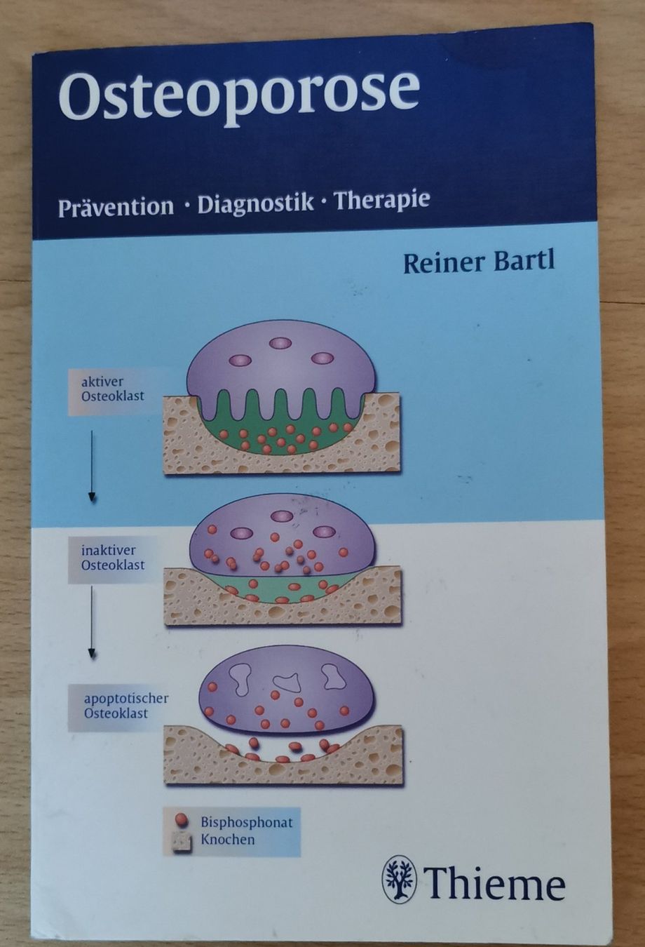 Livres: Osteoporose – D'occasion à Eschenbach LU par Holiday1