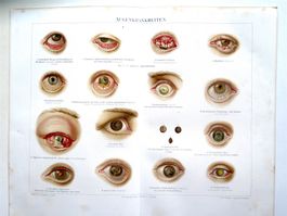 AUGENKRANKHEITEN Schautafel 1896 Vintage