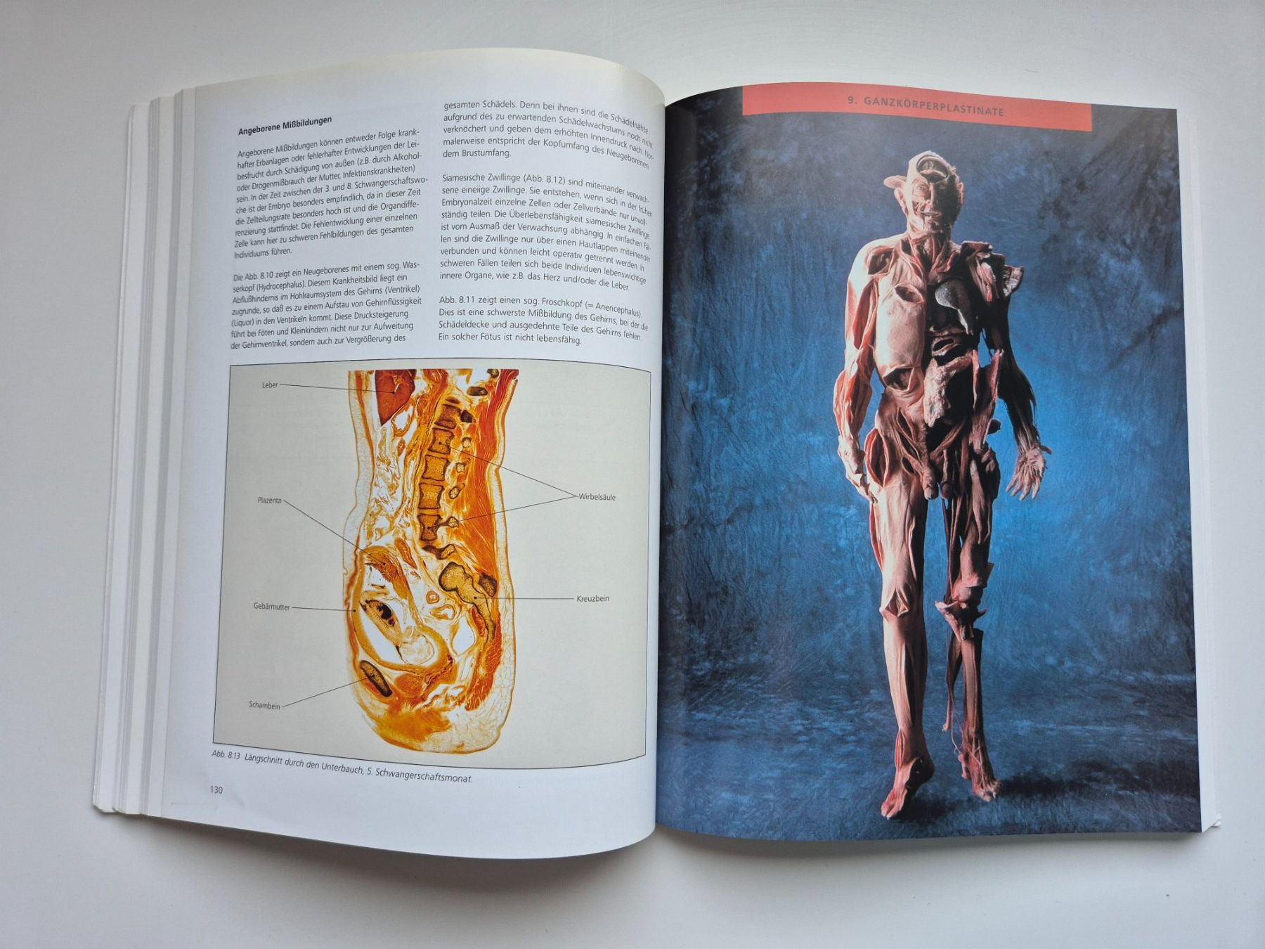 Bücher: KÖRPERWELTEN   🦴🩻 – Gebraucht aus Niederweningen von Obson 6